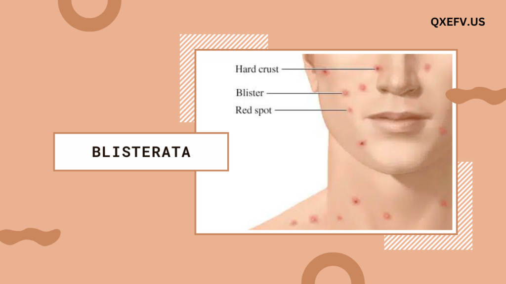 Blisterata